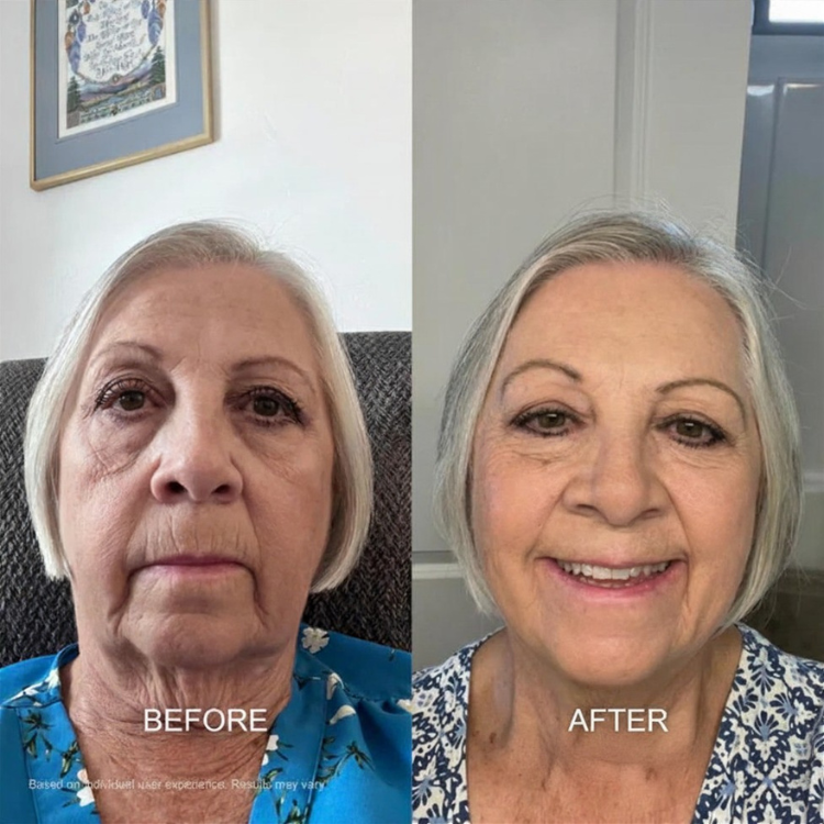Bee Cream Sun Damage