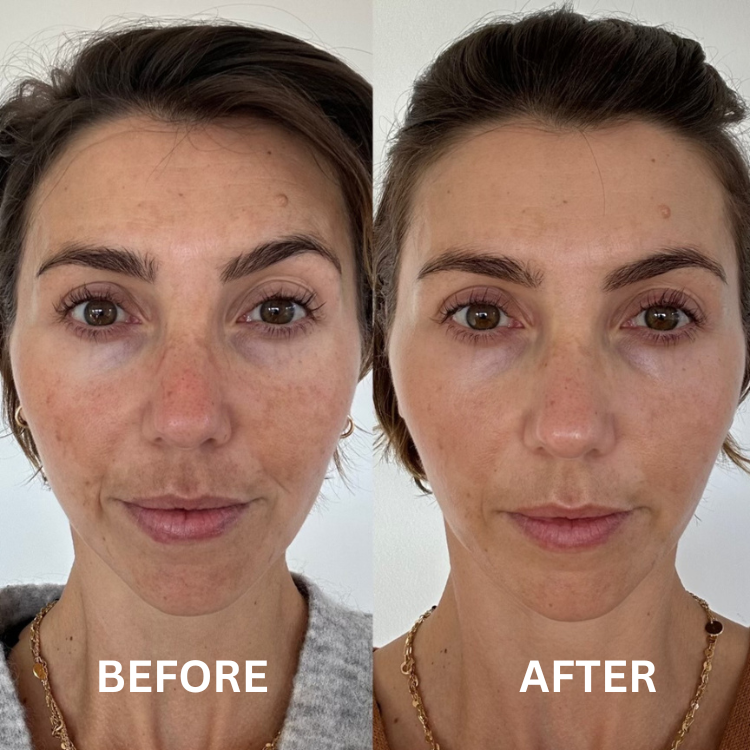 Bee Cream Sun Damage
