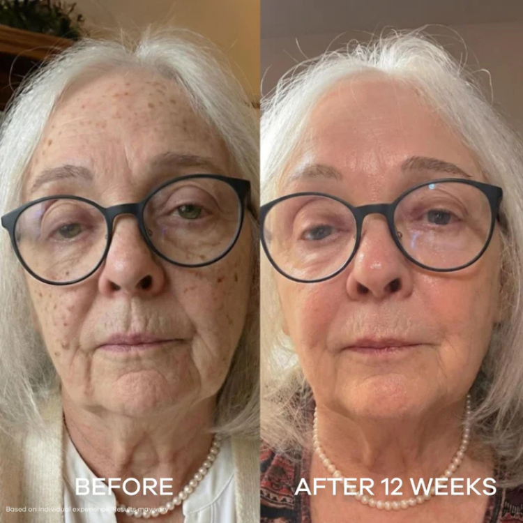 Bee Cream Sun Damage