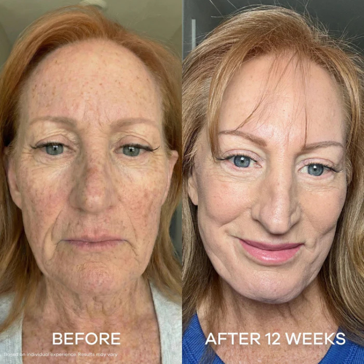 Bee Cream Sun Damage
